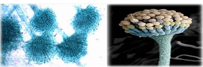 3 cach loai bo nam moc cho nha ve sinh 4