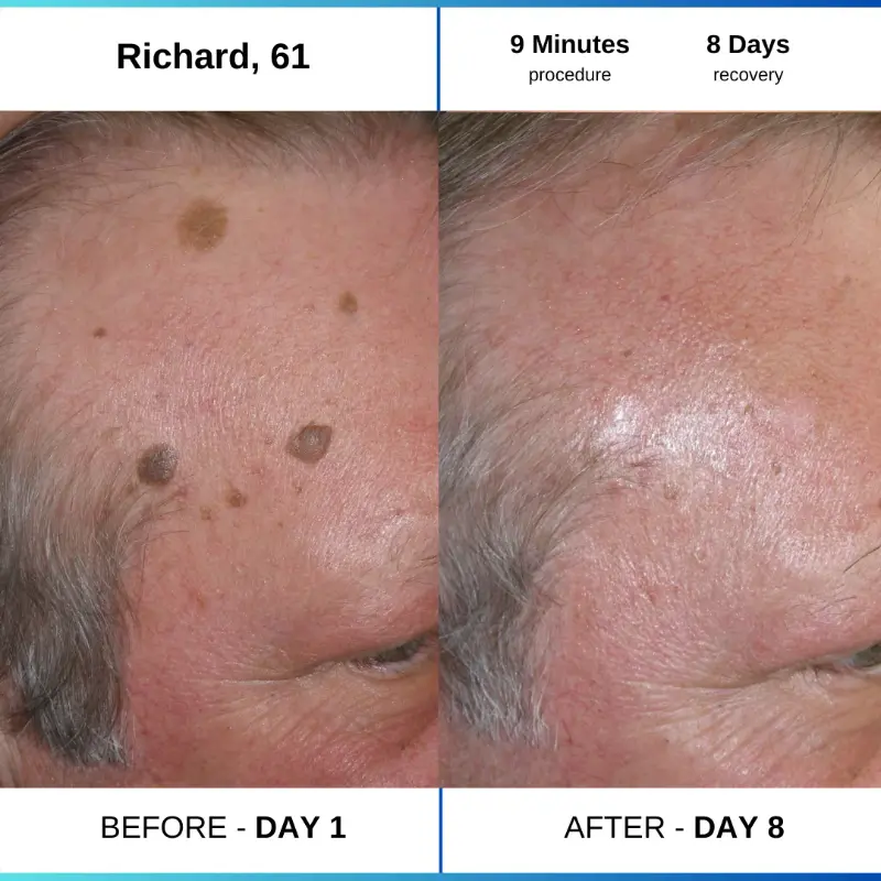 Day 1 2d3344a4 8309 4d49 be5d 9c87eff75489