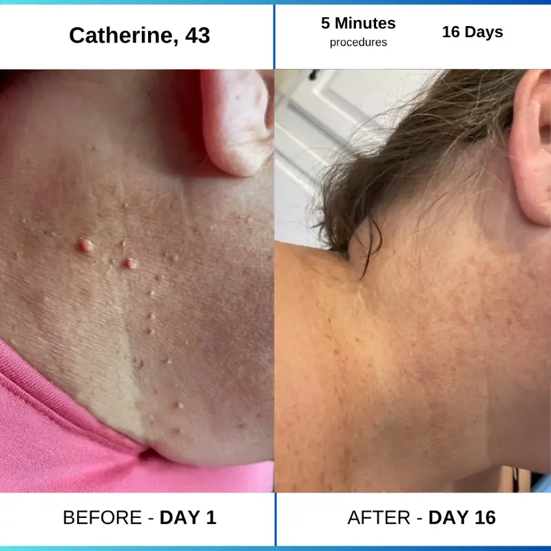 Day 1 3c8a8b3a e5bf 42d9 9e9d 5514cd75063b