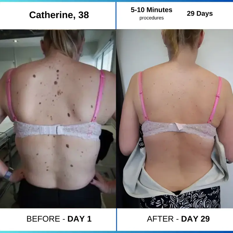 Day 1 4e603017 a791 441a 9edd 984b3a1f1d93