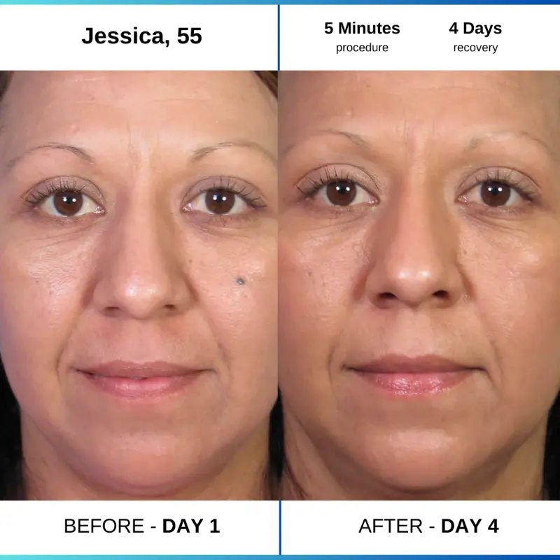 Day 1 a09fa48c b6f0 4a05 84d1 7a59af85a23c